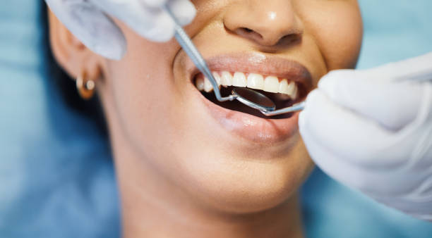 Best Emergency Treatment for Dental Infections or Abscesses in Hilliard, FL